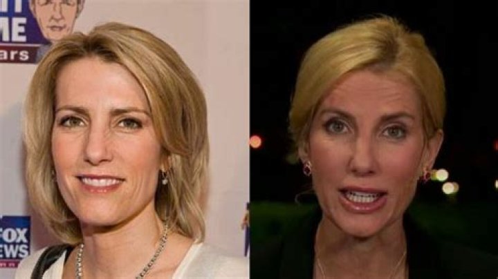 Unveiling Laura Ingraham's Plastic Surgery Journey: Insights And Revelations